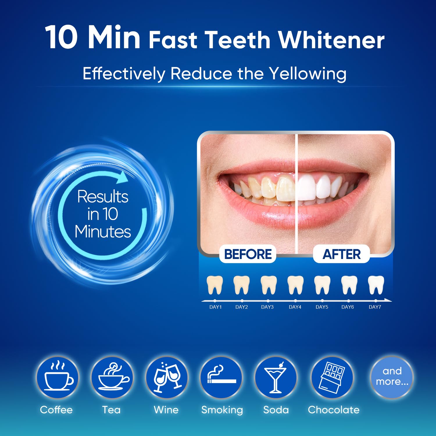 Home Tooth Cleaning Kit with LED Light Accelerator